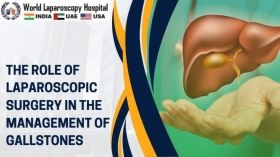 The Role of Laparoscopic Surgery in the Management of Gallstones