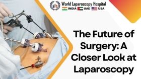 The Future of Surgery: A Closer Look at Laparoscopy