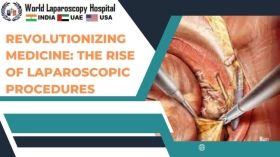 Revolutionizing Medicine: The Rise of Laparoscopic Procedures