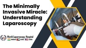 The Minimally Invasive Miracle: Understanding Laparoscopy