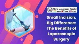 Small Incision, Big Difference: The Benefits of Laparoscopic Surgery