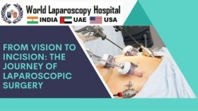 From Vision to Incision: The Journey of Laparoscopic Surgery