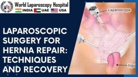 Laparoscopic Surgery for Hernia Repair: Techniques and Recovery