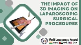 The Impact of 3D Imaging on Laparoscopic Surgical Procedures