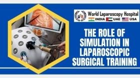 The Role of Simulation in Laparoscopic Surgical Training