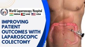 Improving Patient Outcomes with Laparoscopic Colectomy