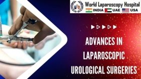 Advances in Laparoscopic Urological Surgeries