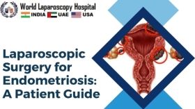 Laparoscopic Surgery for Endometriosis: A Patient Guide