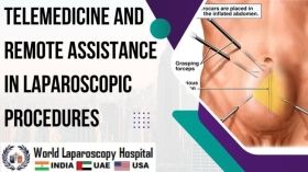 Telemedicine and Remote Assistance in Laparoscopic Procedures