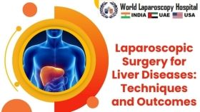 Laparoscopic Surgery for Liver Diseases: Techniques and Outcomes