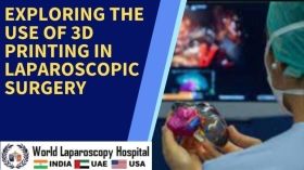 Exploring the Use of 3D Printing in Laparoscopic Surgery