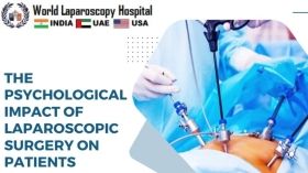 The Psychological Impact of Laparoscopic Surgery on Patients