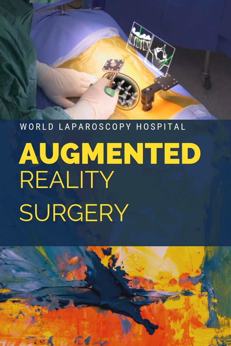 Augmented Reality Laparoscopic Surgery
