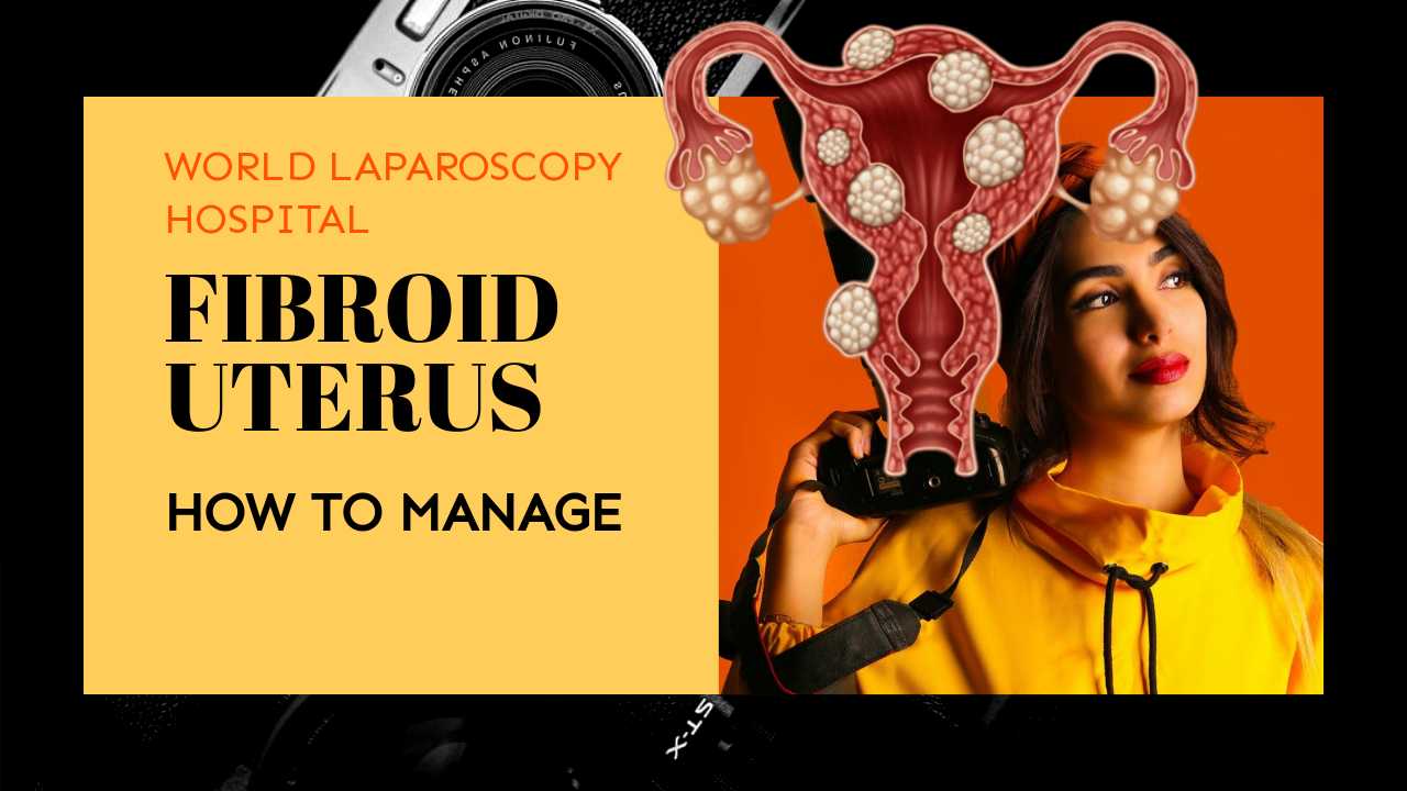 How to Manage Fibroid Uterus