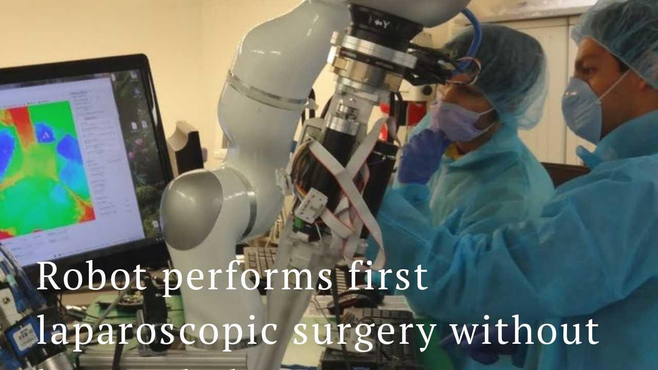 Robot performs first laparoscopic surgery without doctor's help