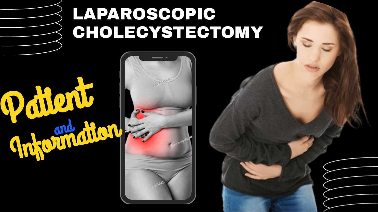 Información útil para el paciente sobre colecistectomía laparoscópica