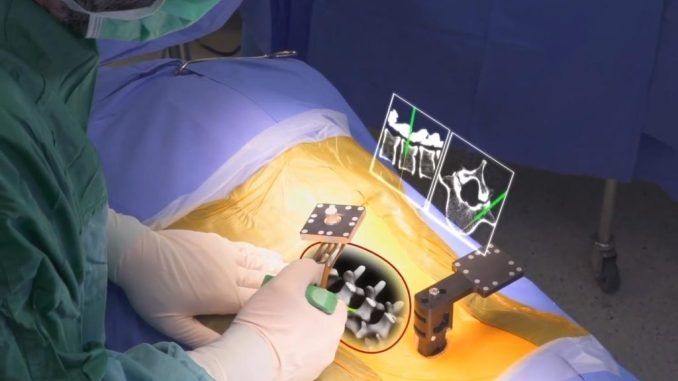 Cirugía laparoscópica de realidad aumentada