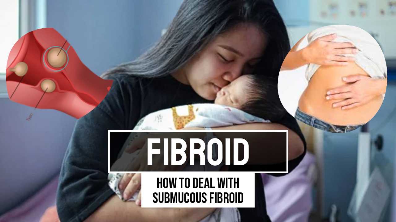 Submucous Fibroid سے متعلق مریض کی اہم معلومات۔