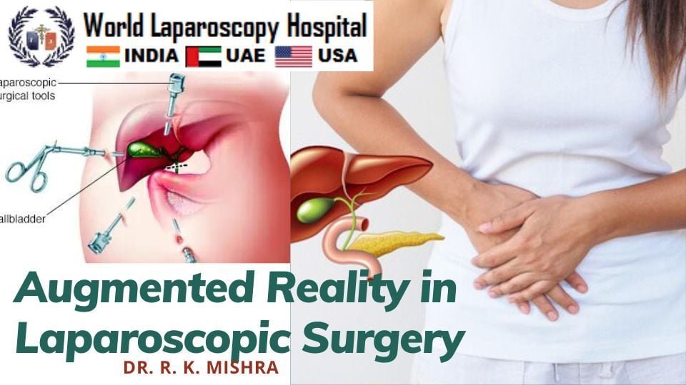 Augmented Reality in Laparoscopic Surgery