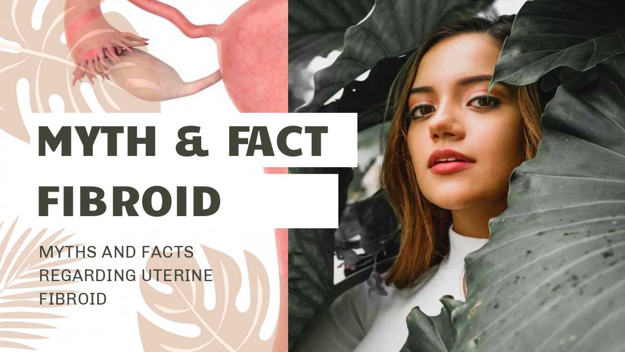 Myths and Facts Regarding Uterine Fibroid