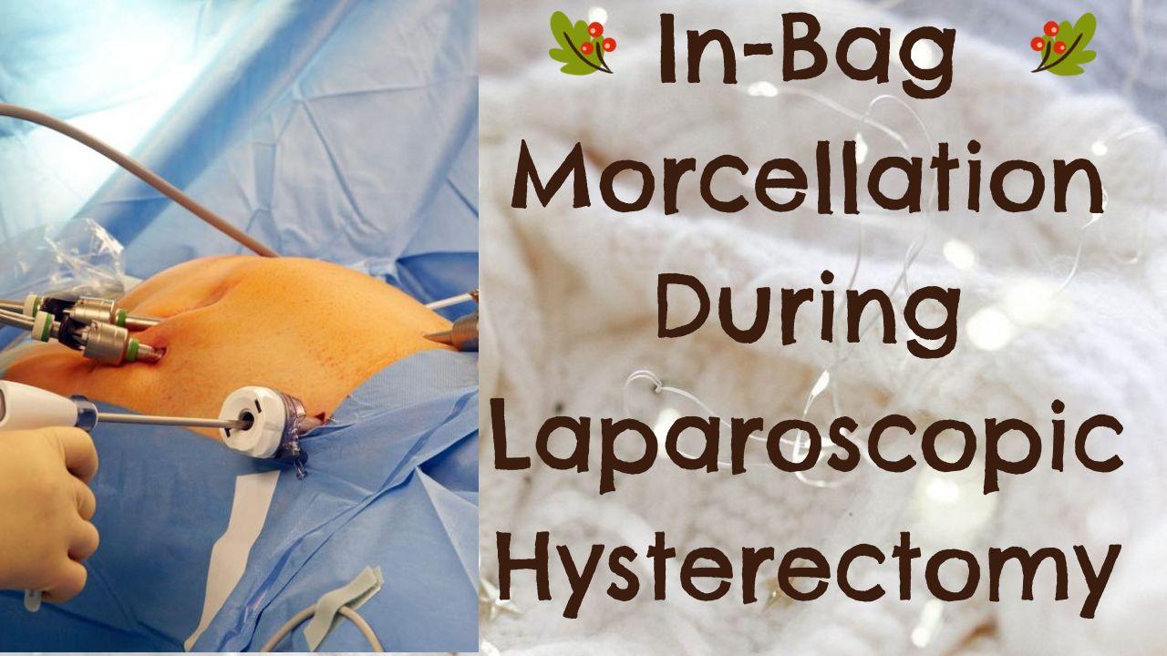 In-Bag Morcellation During Laparoscopic Hysterectomy